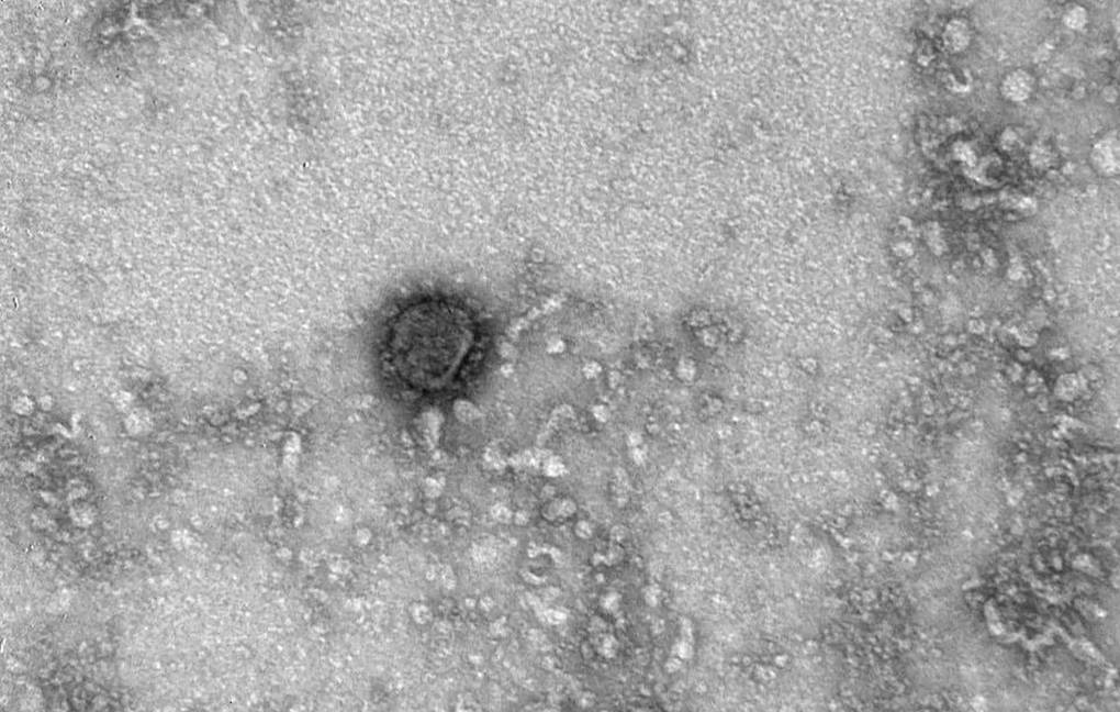 Pubblicate le prime immagini di un coronavirus al microscopio