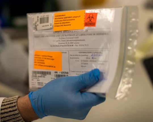 Un test americano sarebbe in grado di rilevare il coronavirus in cinque minuti