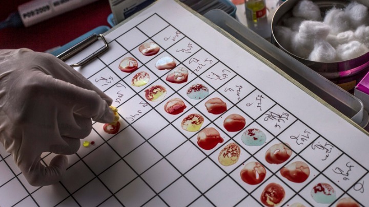 Il primo esame del sangue "intelligente" per rilevare con precisione più di 50 tipi di cancro